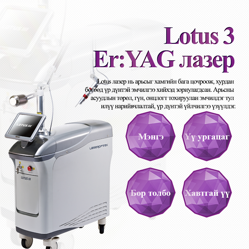 Lotus3 лазер - VandS - Ёгсам (ганнам) салбар