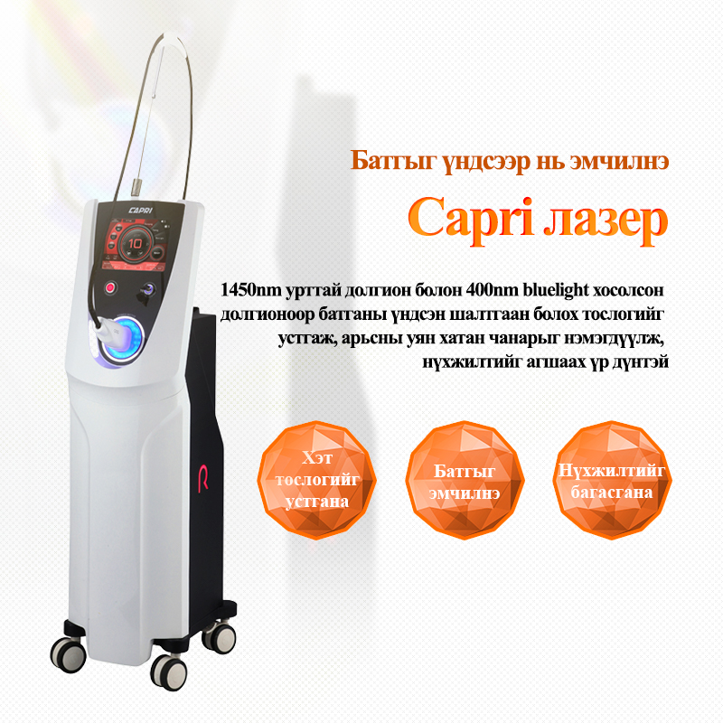 Capri лазер - VandS - Ёгсам (ганнам) салбар