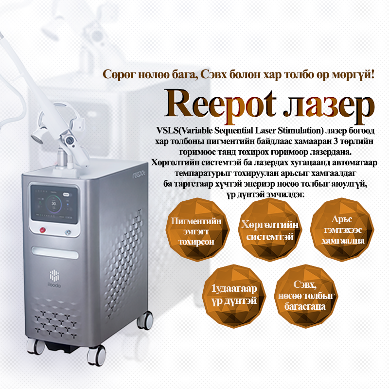 Reepot лазер - VandS - Ёгсам (ганнам) салбар